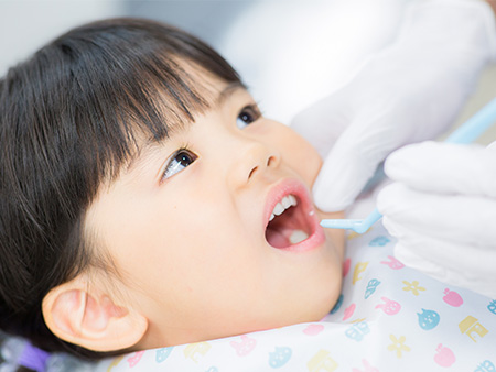 お子さまの将来の口腔衛生は早めのケアがカギ